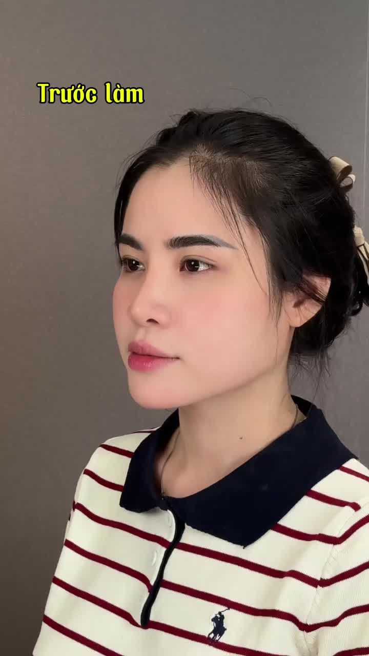 MŨI 7 NGÀY VÀO FORM XUẤT SẮC - SỞ HỮU THẦN THÁI XINH ĐẸP!!