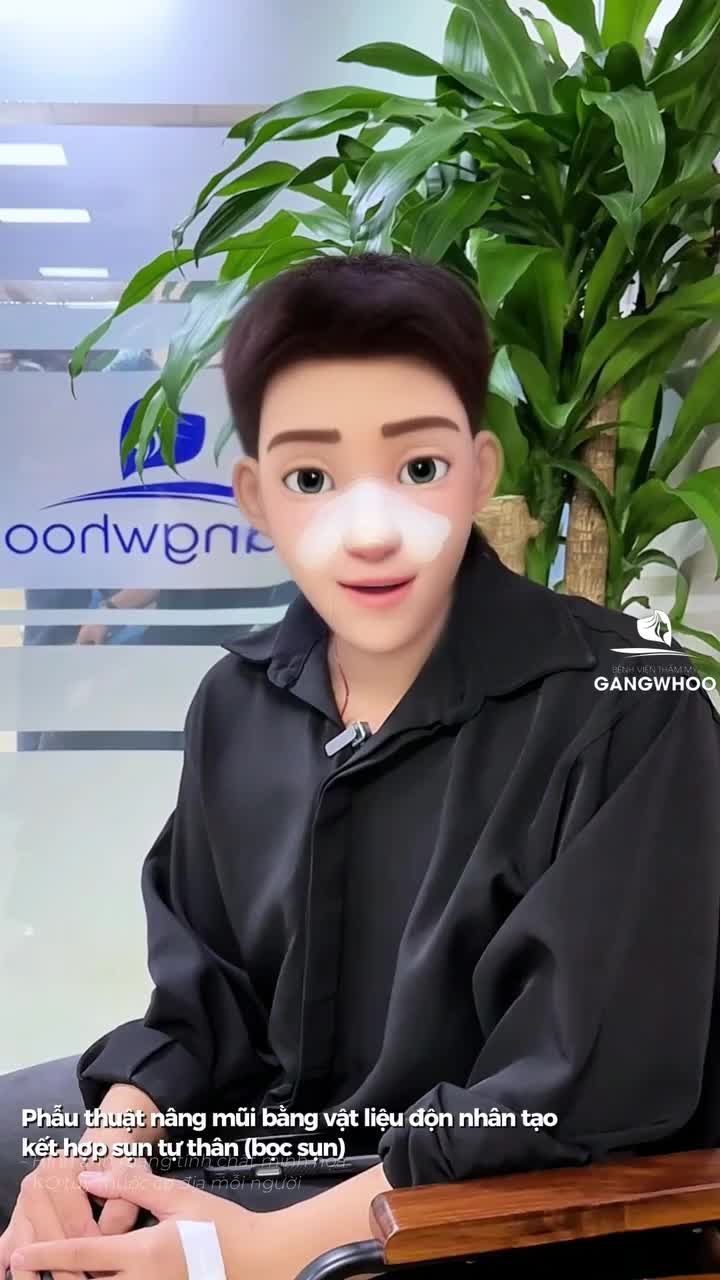 Khách hàng feedback thật sau khi thực hiện phẫu thuật nâng mũi bằng vật liệu độn nhân tạo kết hợp sụn tự thân