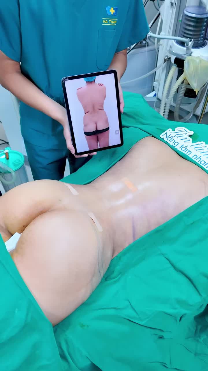 Kết quả "độ" vòng 3 "trái đào" cho chị khách hàng là đây Mời các bạn cùng theo dõi nhé!