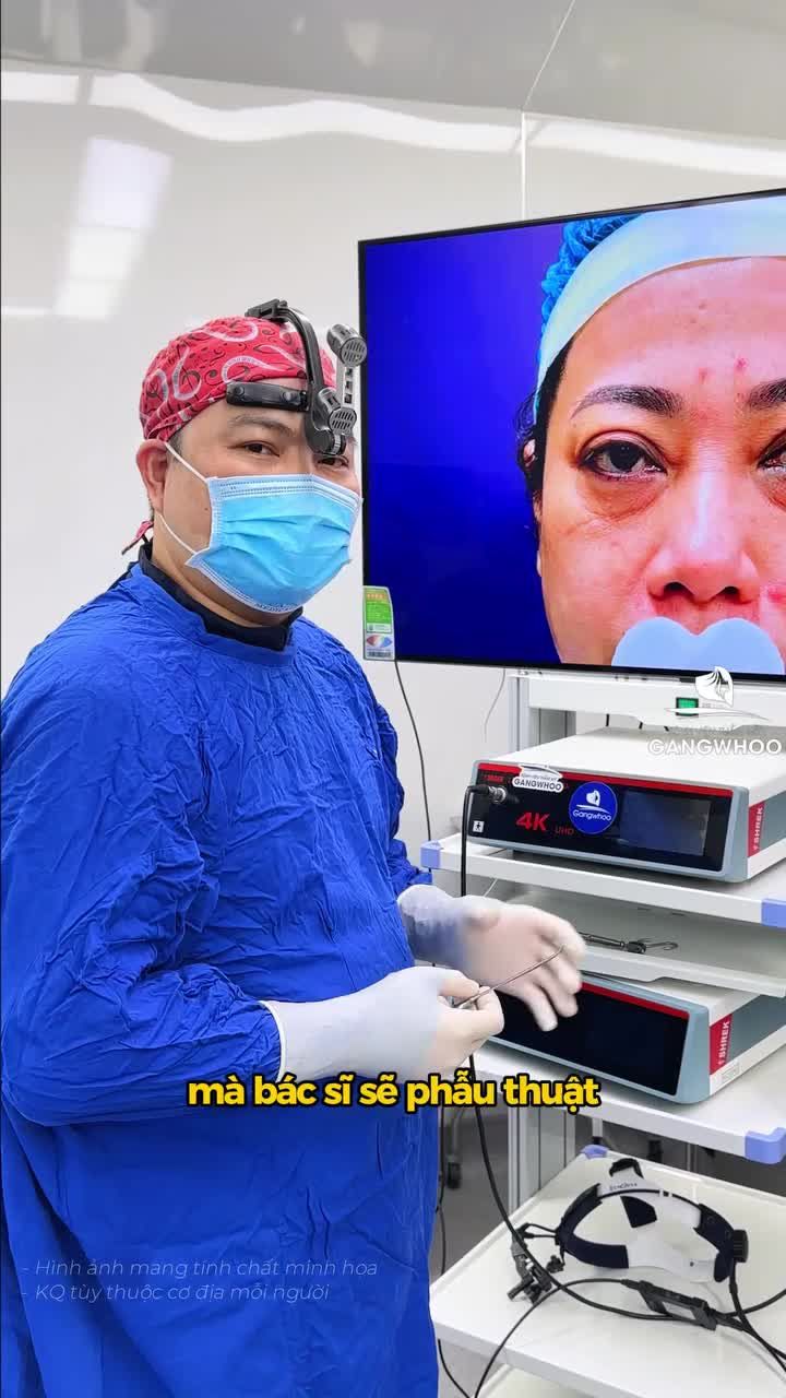 Bác sĩ phân tích kỹ thuật Midface, nâng tầng mặt giữa và trẻ hóa vùng mi dưới. Kết hợp nội soi 4K giúp thao tác chính xác và mang lại hiệu quả thẩm mỹ cao.