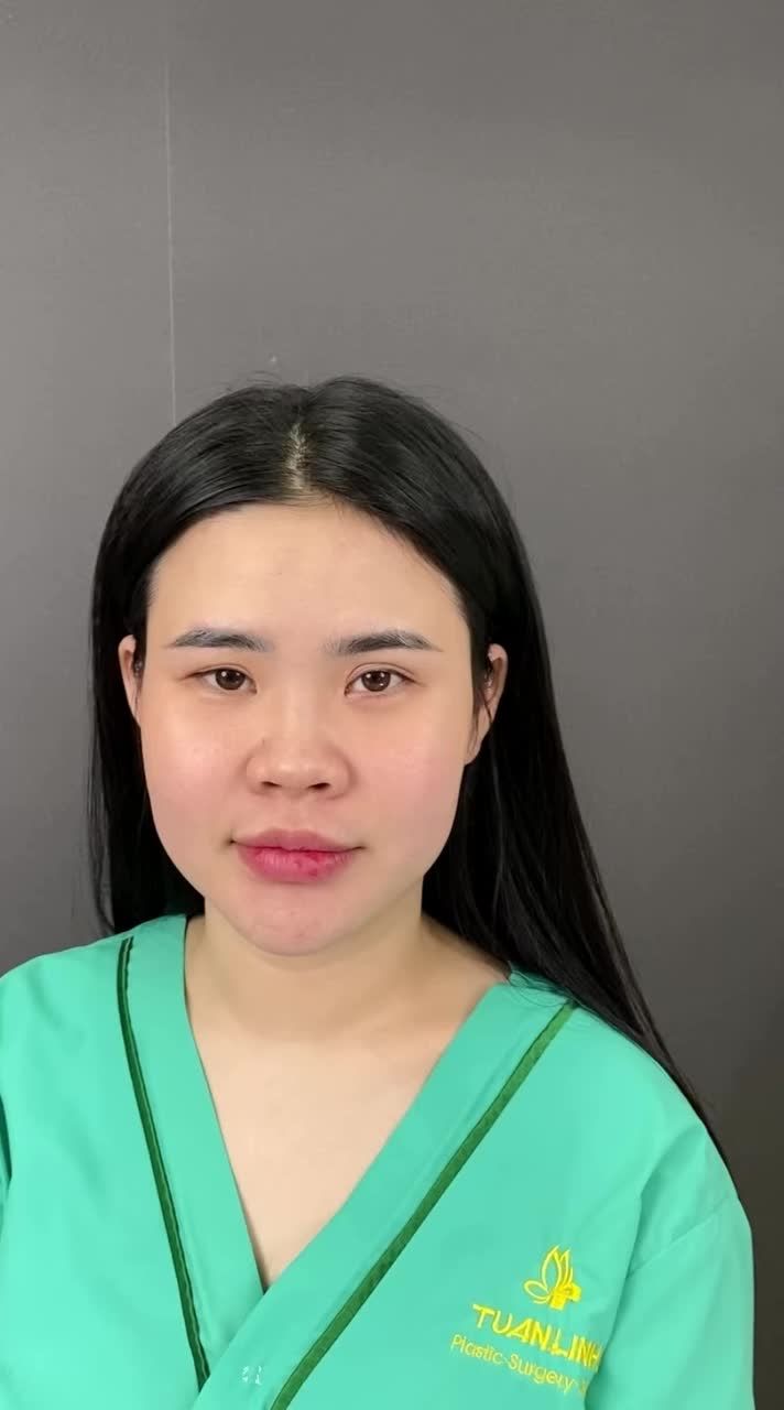 Đừng để chiếc mũi thấp tẹt ''phong ấn'' nhan sắc bạn!!