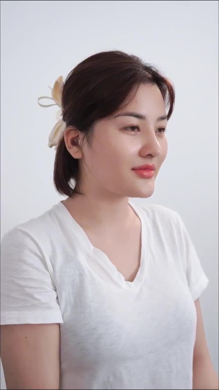 KẾT QUẢ NÂNG MŨI SAU 9 NGÀY – CỦA BẠN KHÁCH HÀNG 2K2