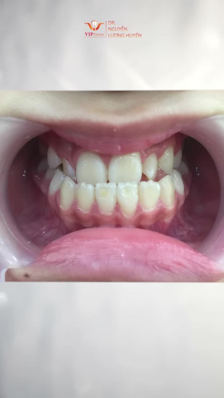 Có những nụ cười chưa bao giờ được trọn vẹn vì các vấn đề về răng miệng.