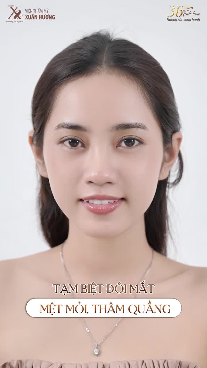 TẠM BIỆT ĐÔI MẮT MỆT MỎI – THỨC TỈNH ÁNH NHÌN RẠNG RỠ