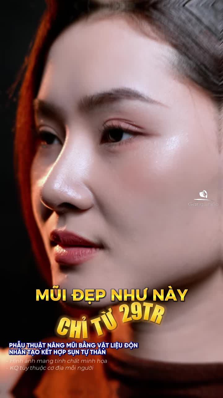 Mũi đẹp như này mà chỉ từ 29tr á