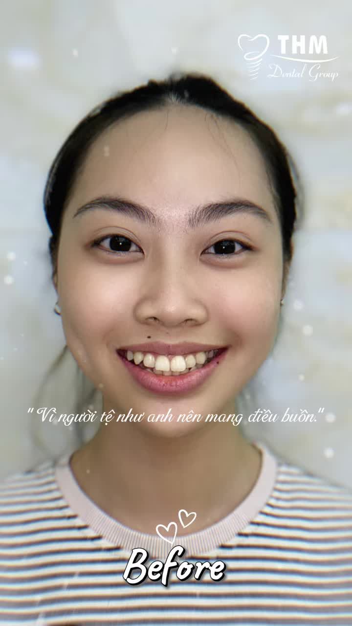 Có những nụ cười từng e ngại… Nhưng chỉ cần một hành trình đúng hướng, mọi thứ đều có thể thay đổi.