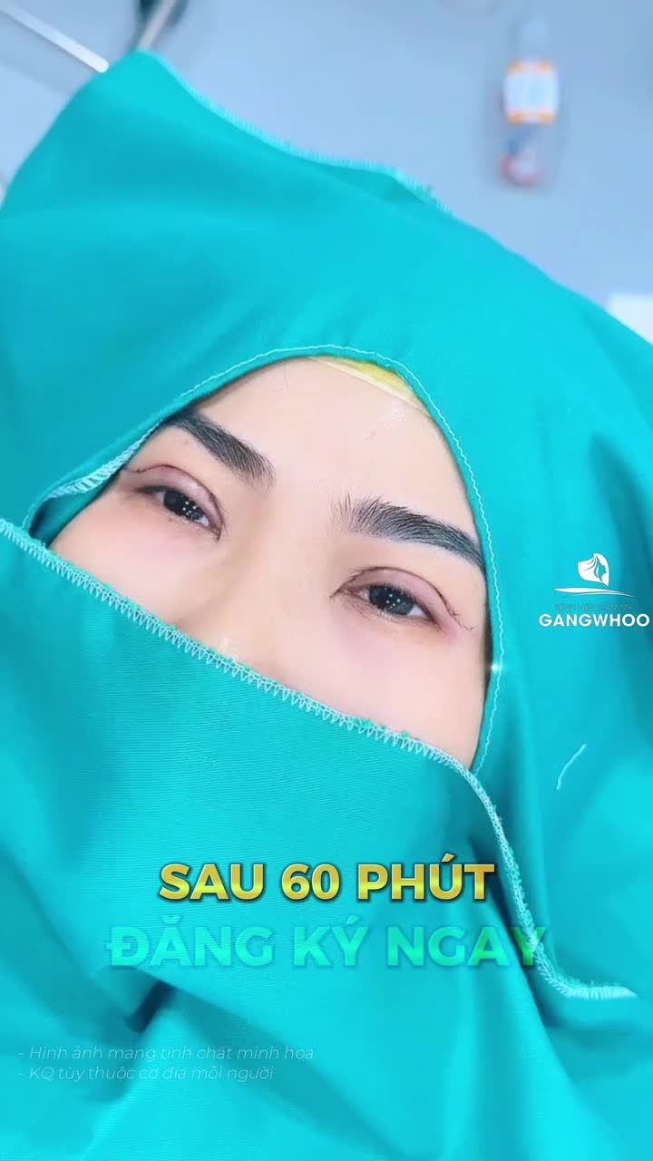 Đừng để khuyết điểm khiến bạn kém rạng rỡ. Thay đổi ngay hôm nay với quy trình AN TOÀN – NHẸ NHÀNG tại Gangwhoo!