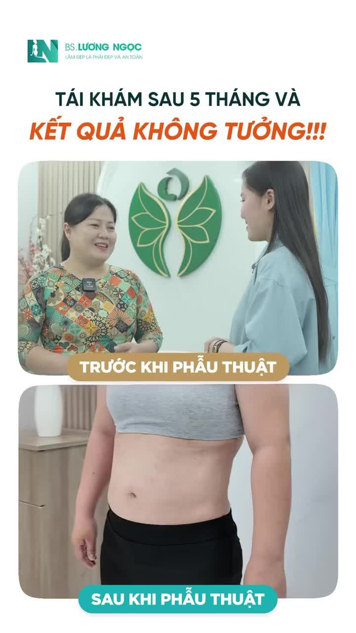 Từ mệt mỏi vì bụng 99cm đến tự tin với eo 75cm – Hành trình của người phụ nữ dám làm lại