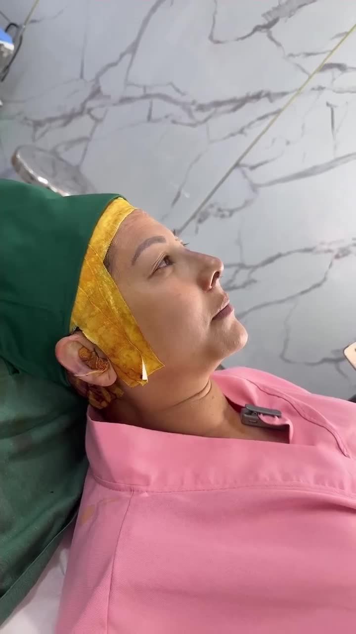 KẾT QUẢ SAU 60 PHÚT NÂNG MŨI CẤU TRÚC SỬA LẠI KH. TUYẾT BĂNG (VIỆT KIỀU ÚC)