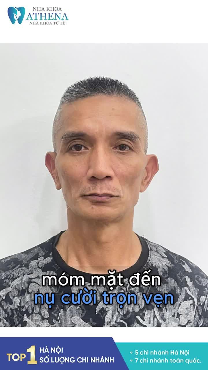 HÀNH TRÌNH TÁI SINH NỤ CƯỜI CỦA CHÚ NGUYỄN TIẾN THANH