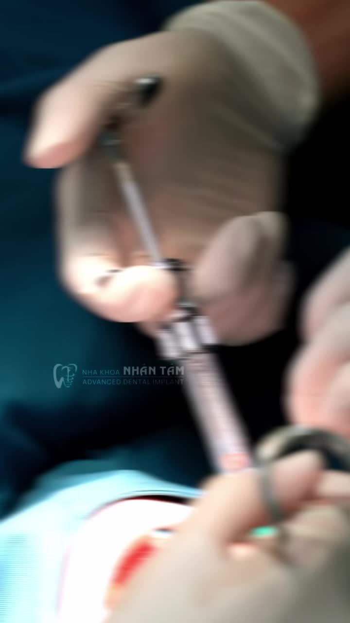 DẪN LỐI NỤ CƯỜI KHỎE – ĐIỀU TRỊ NƯỚU ĐÚNG CÁCH