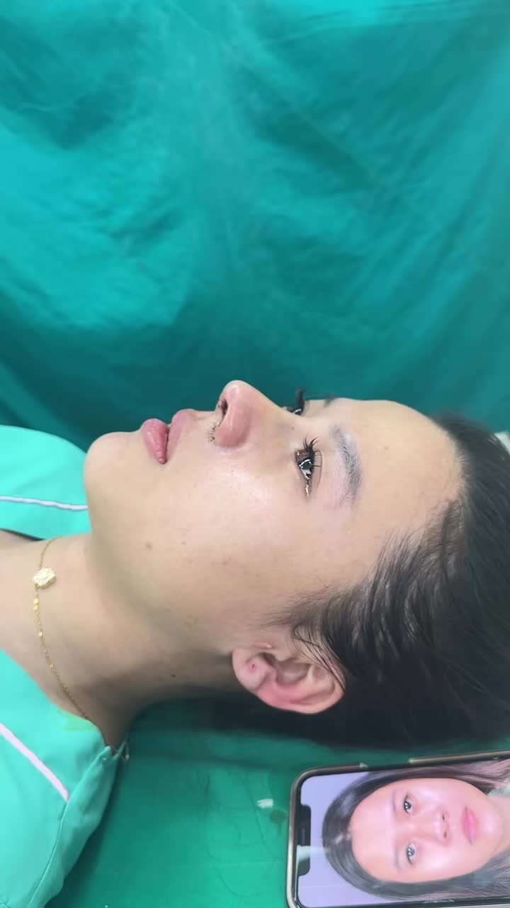 Mũi cấu trúc cắt cánh vừa hoàn thành