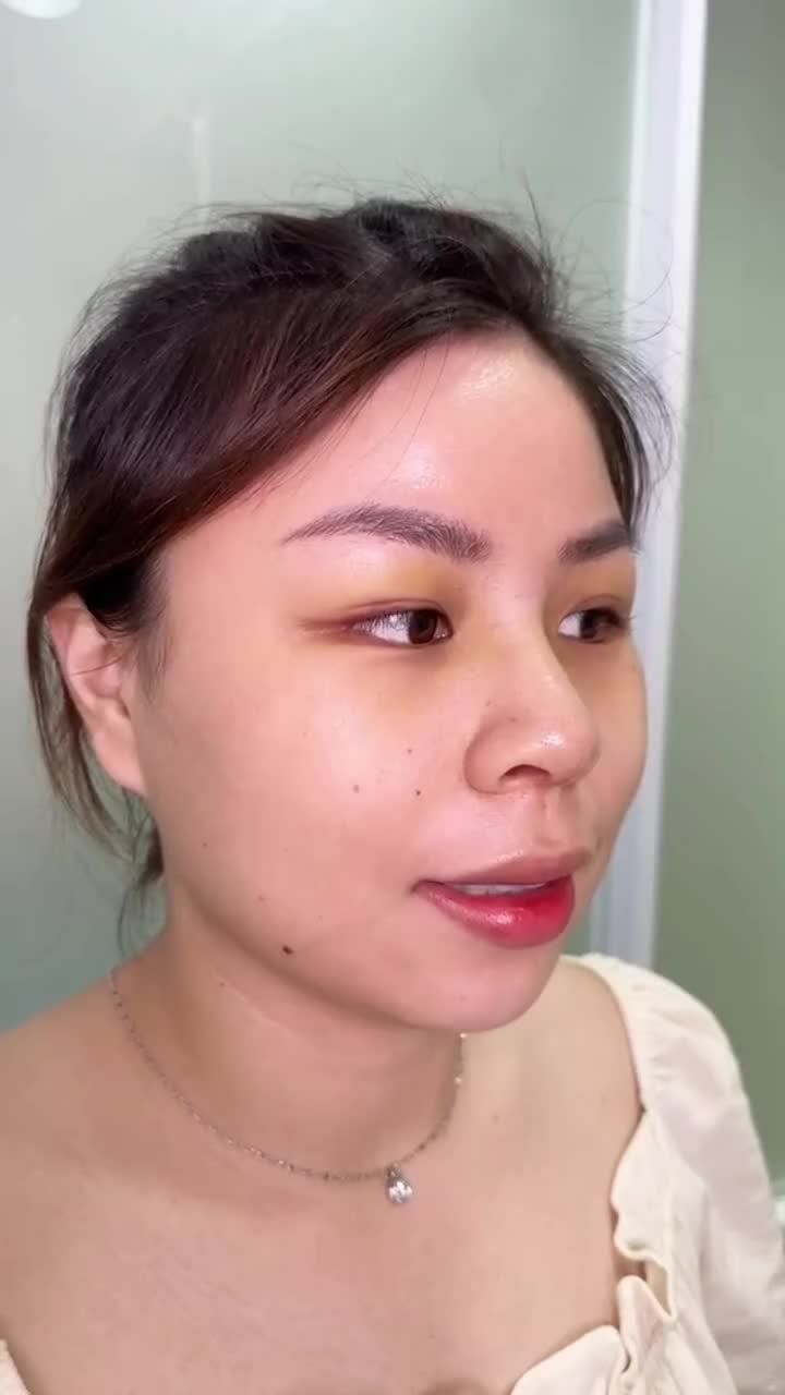 GEN Z MIỀN TÂY HOÁ MỸ NHÂN VỚI DÁNG MŨI CAO SANG SAU 7 NGÀY NÂNG MŨI S LINE 3D TẠI JW