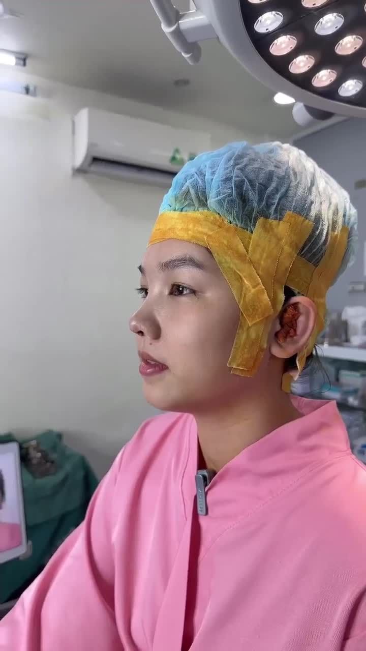 HOÀN THÀNH DÁNG MŨI CẤU TRÚC CHO EM KHÁCH 2K1