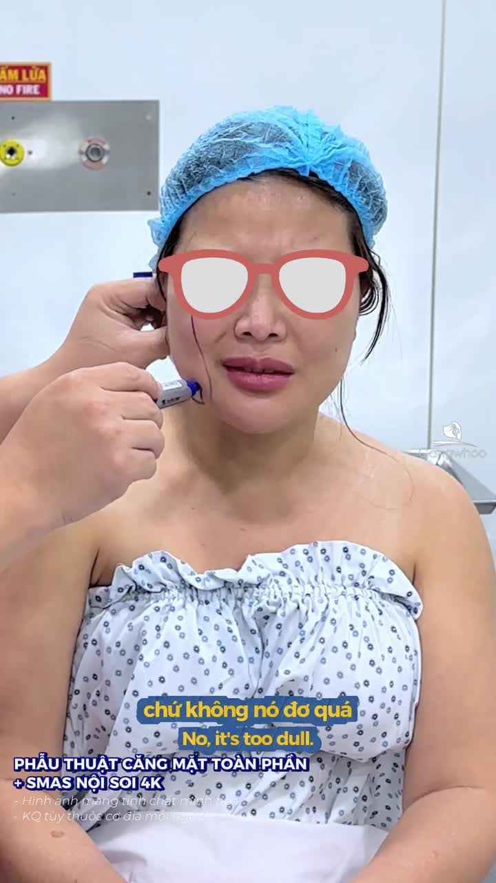 Bác sĩ thăm khám đo vẽ cho khách hàng trước khi thực hiện phẫu thuật căng mặt toàn phần + Smas nội soi 4k
