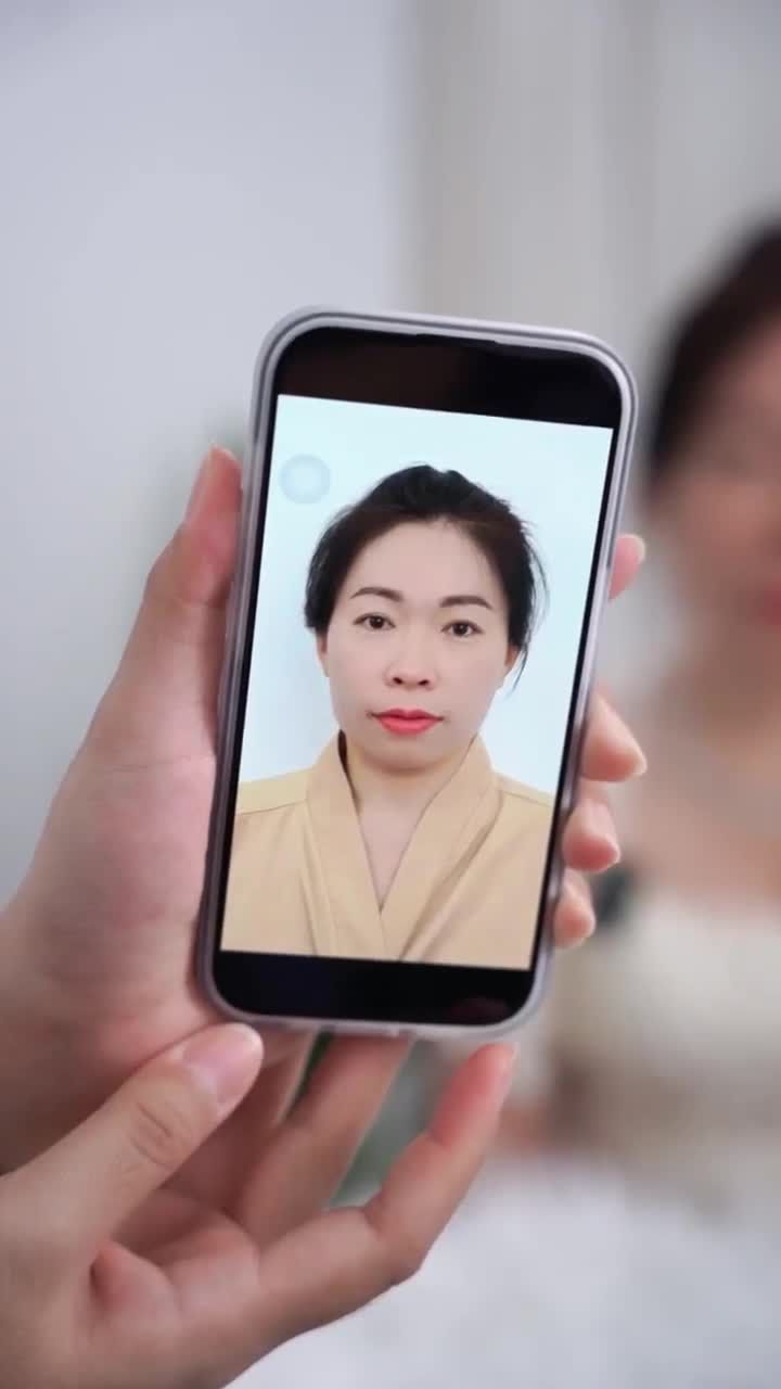 TÁI KHÁM – KẾT QUẢ SAU 2 THÁNG NÂNG MŨI CẤU TRÚC DR.HOẠT