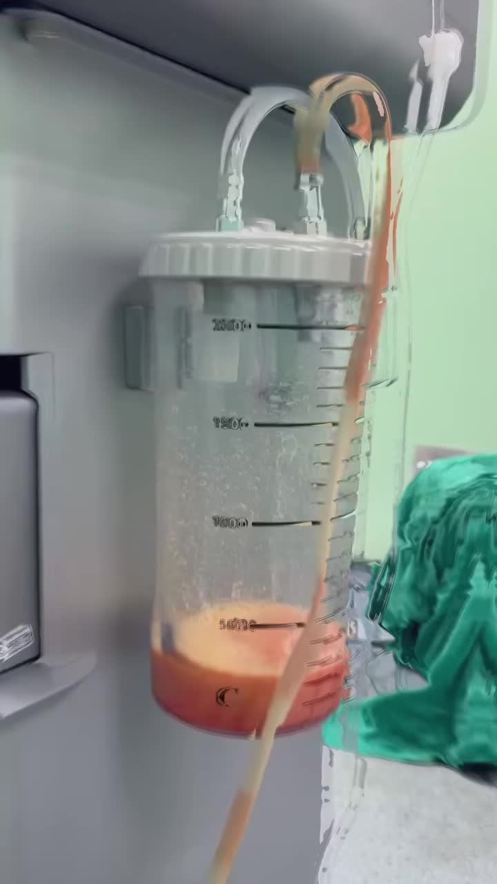 E LÀ KHÔNG THỂ? KHÔNG THỂ KHÔNG ĐẸP