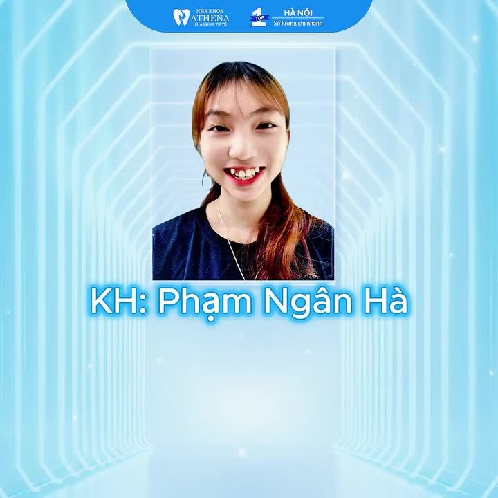 TOP 3 CA NIỀNG RĂNG THÀNH CÔNG NHẤT TẠI NHA KHOA ATHEN!