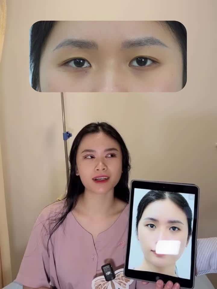 "Cảm nhận như 1 con người khác" đây là chia sẽ của Chị Long ngay sau khi làm mí