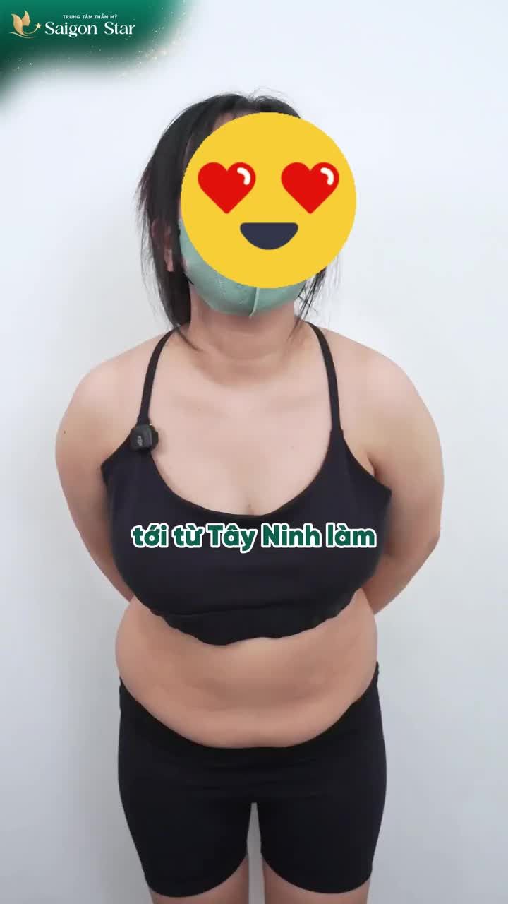 BÁC SĨ HOẠT HOÀN THÀNH MONG ƯỚC SỞ HỮU VÒNG EO 56 CỦA MẸ BỈM SỮA