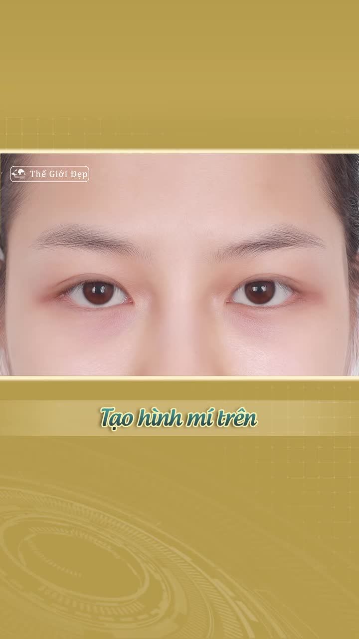 Da chùng, mí sụp - dấu hiệu nhỏ, thay đổi lớn khi biết xử lý đúng cách