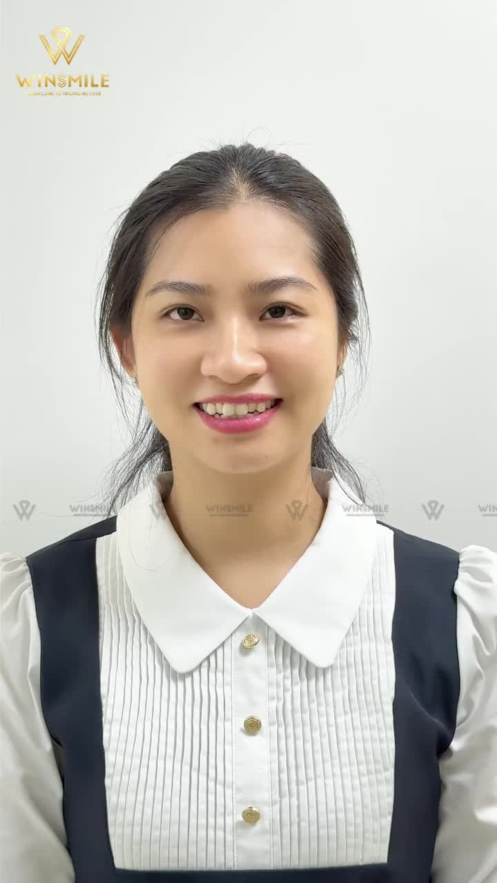 Những lắng lo về việc  “chọn dáng răng này có thật sự hợp với khuôn mặt của mình không?", "có giúp mình sở hữu một diện mạo hoàn hảo ở mọi góc nhìn không?",... là những băn khoăn dễ gặp ở mỗi khách hàng làm thẩm mỹ.