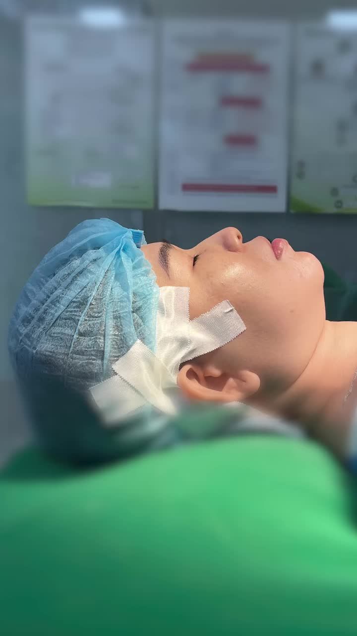 Những điều lưu ý khi sụn mỏng, da mỏng khi làm mũi