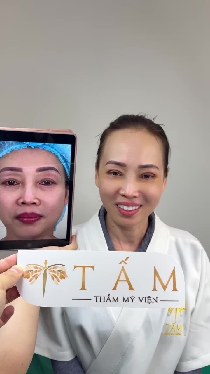 Cô Tuyết đã làm gì để gương mặt tươi  hơn?