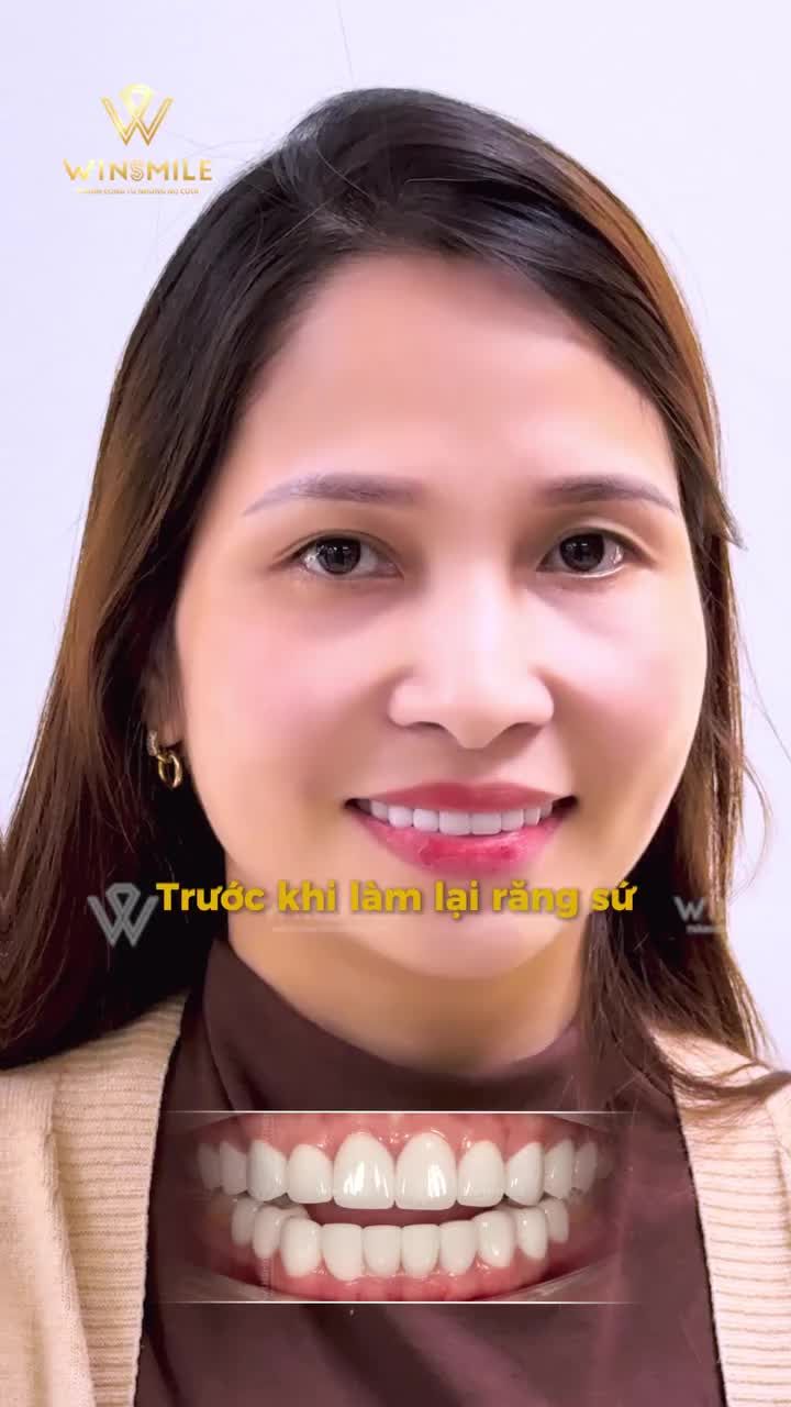 Hai tuần sau khi làm răng ở quê nhưng không ưng ý, chị Trần Thị Sinh quyết định tìm một nơi đủ tin tưởng để “cứu” nụ cười của mình.