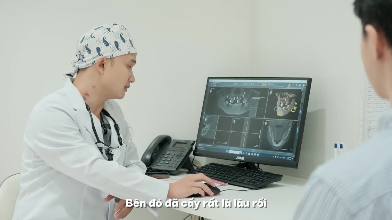 CẮM IMPLANT BỊ ĐAU NỬA ĐẦU, GIẢI PHÁP NÀO CHO TRỤ IMPLANT "ĐI LẠC" VÀO XOANG??