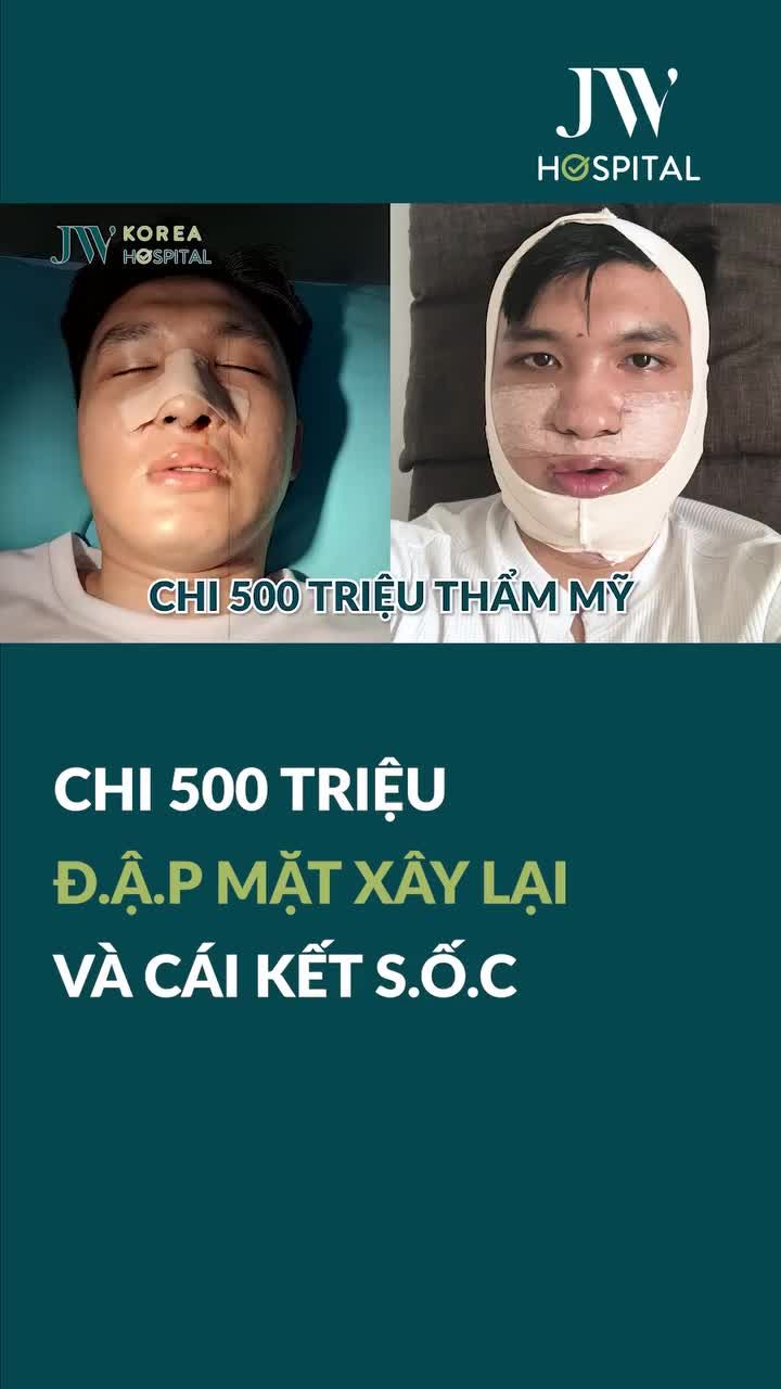SỐC ÓC CHI 500 TRIỆU CHO 4 CA PHẪU THUẬT THẨM MỸ HÀM MÓM, NÂNG MŨI, BỌC SỨ, NIỀNG RĂNG GEN Z ĐỔI ĐỜI