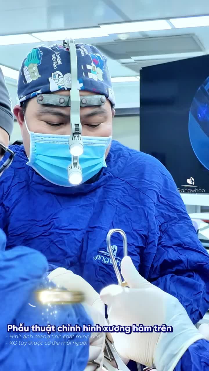 Phẫu thuật chỉnh xương hàm trên cho chị khách Việt Kiều gen Z và cái kết sau 1 tuần