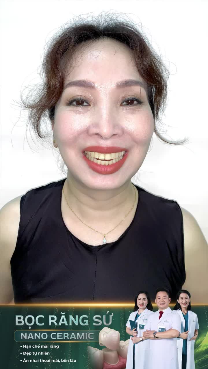 Tự tin hơn sau bọc răng sứ