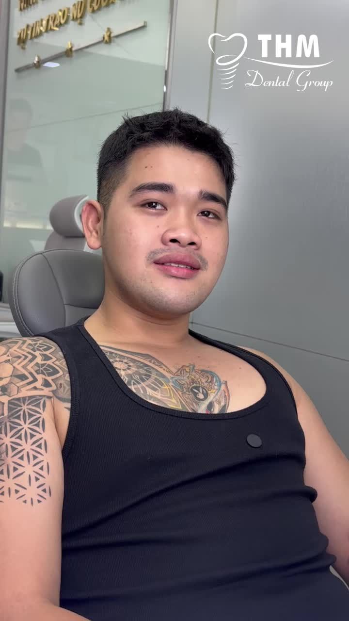 Hành trình thay đổi gương mặt chỉ sau 1 năm niềng răng của bạn Trí