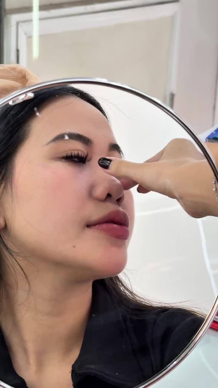 Tạm biệt filler Sở hữu dáng mũi đẹp tự nhiên, bền chắc dài lâu.