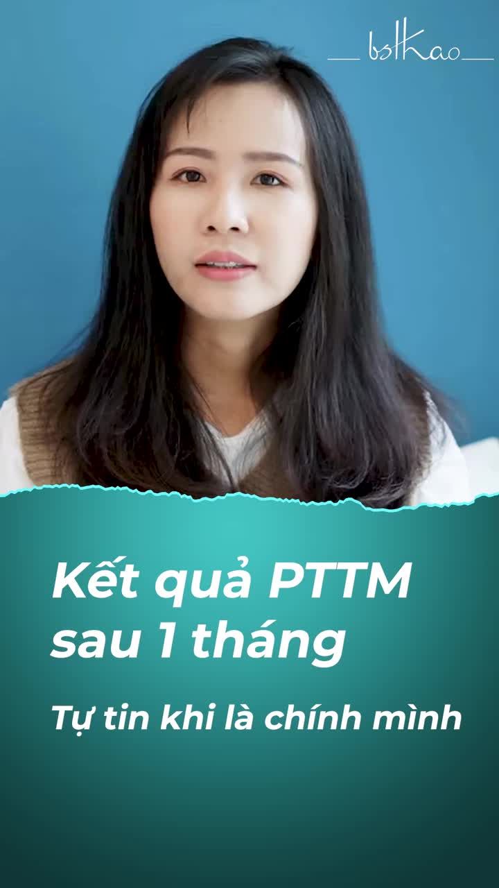 KQ 1 THÁNG SAU KHI LẤY TÚI MỠ MẮT, GIẢM MỠ MÁ TRONG VÀ CẤY MỠ CÂN CHỈNH KHUÔN MẶT