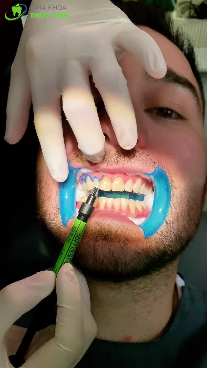 TẨY TRẮNG NGAY HÔM NAY – KỊP BẬT TONE TRẮNG SÁNG ĐÓN TẾT