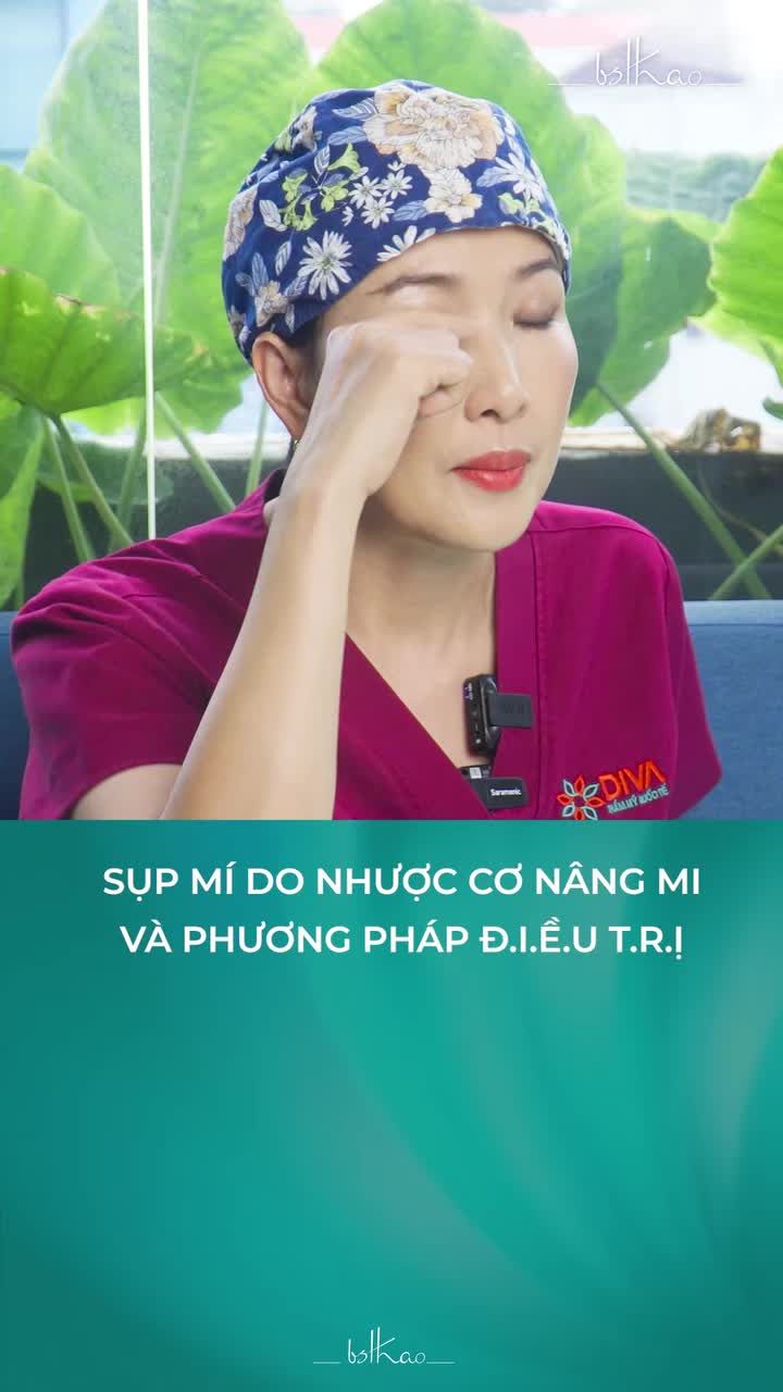 NHƯỢC CƠ NÂNG MI KHIẾN MẮT LỜ ĐỜ - LÀM GÌ ĐỂ CẢI THIỆN?