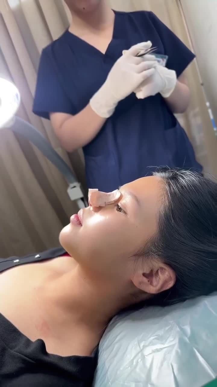 KHOẢNH KHẮC THÁO NẸP MŨI LỘ CỰC PHẨM!