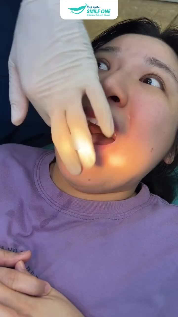 Có thể mọi người không tin nhưng nhổ răng không chưa tới 1 phút là có thật!