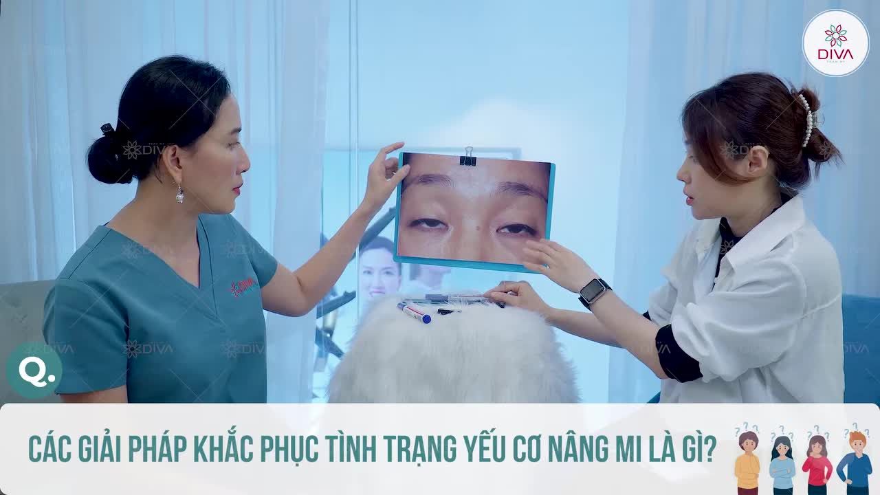 BỊ YẾU CƠ NÂNG MI THÌ LÀM CÁCH GÌ ĐỂ CẢI THIỆN?