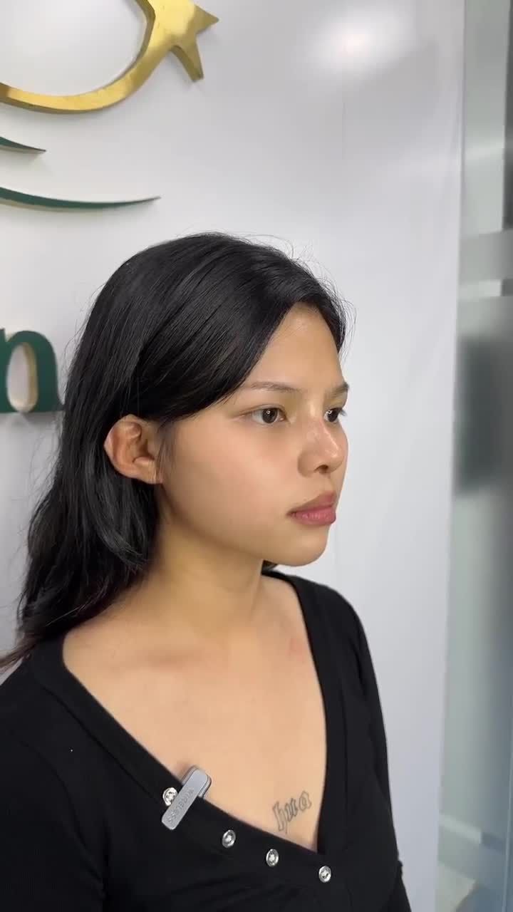 KHÁCH HÀNG GENZ KHOE DÁNG MŨI MỚI SAU 10 NGÀY
