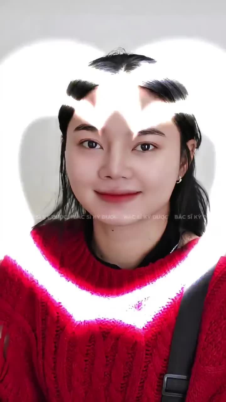 11 NGÀY SAU NÂNG MŨI MESODERM – DÁNG MŨI VÀO FORM CỰC ĐẸP!