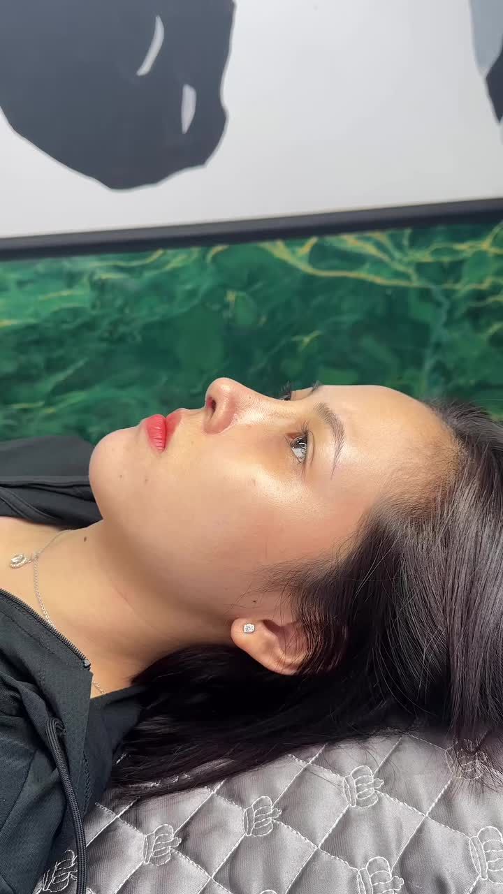 Mũi 1 tháng làm cấu trúc tại Tuấn Linh