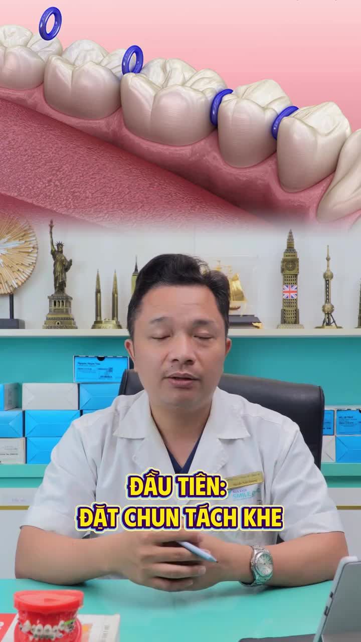 Đồng niềng nào trải qua 3 giai đoạn này rồi thì xác nhận giúp nha khoa xem có chính xác không nào?