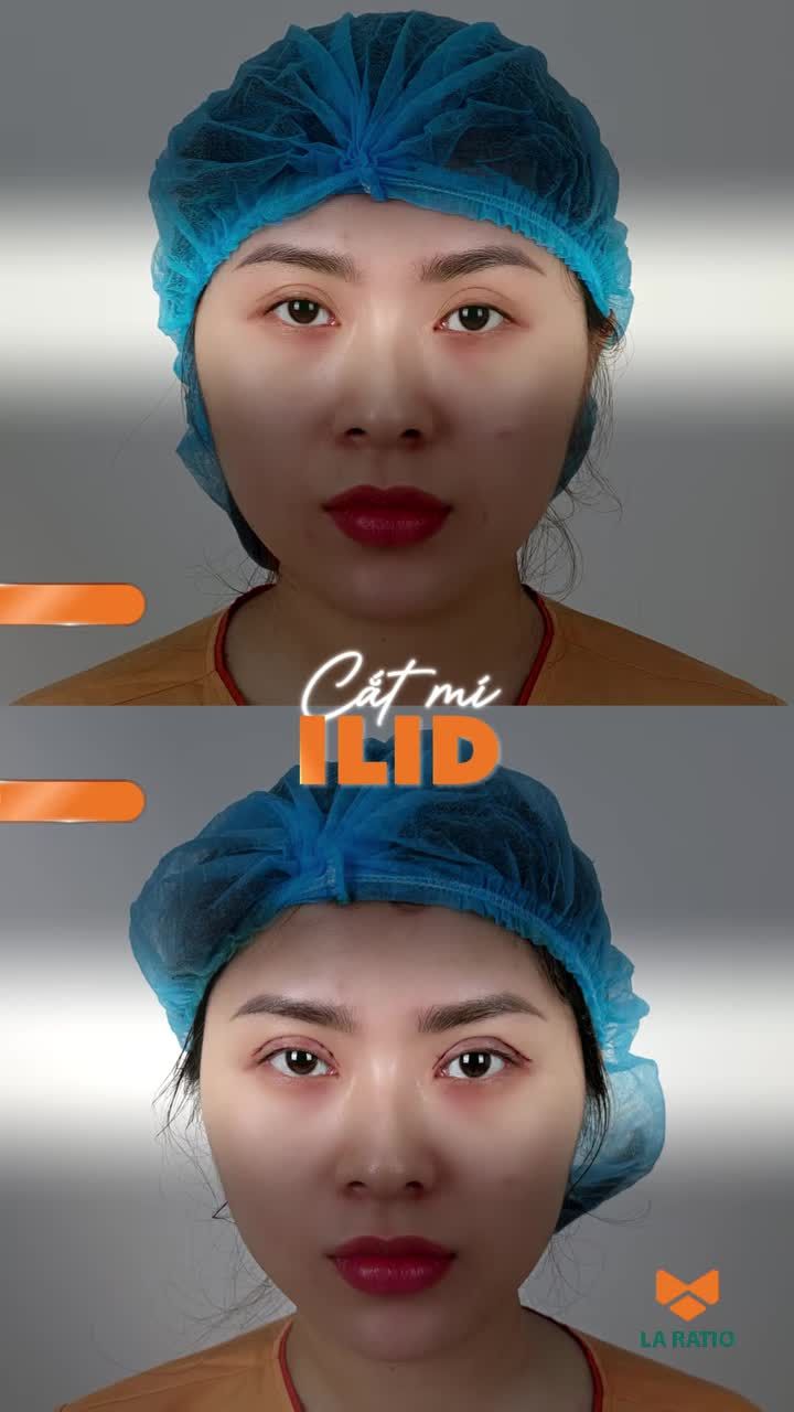 Một chạm nhỏ - một thay đổi lớn.