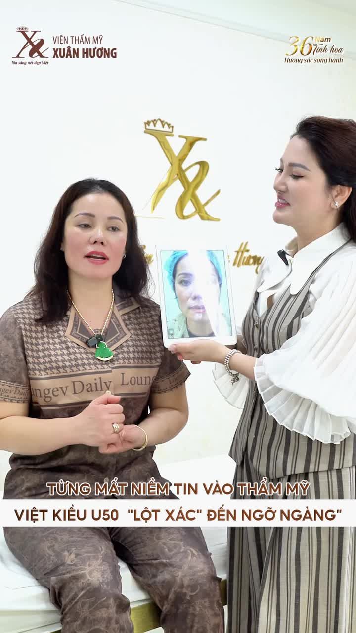 TỪNG MẤT NIỀM TIN VÀO THẨM MỸ, VIỆT KIỀU U50 LỘT XÁC ĐẾN NGỠ NGÀNG