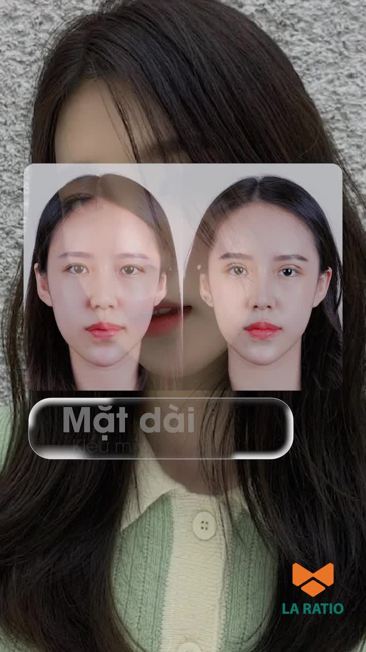 Không có mí đẹp nhất. Chỉ có mí hợp nhất.