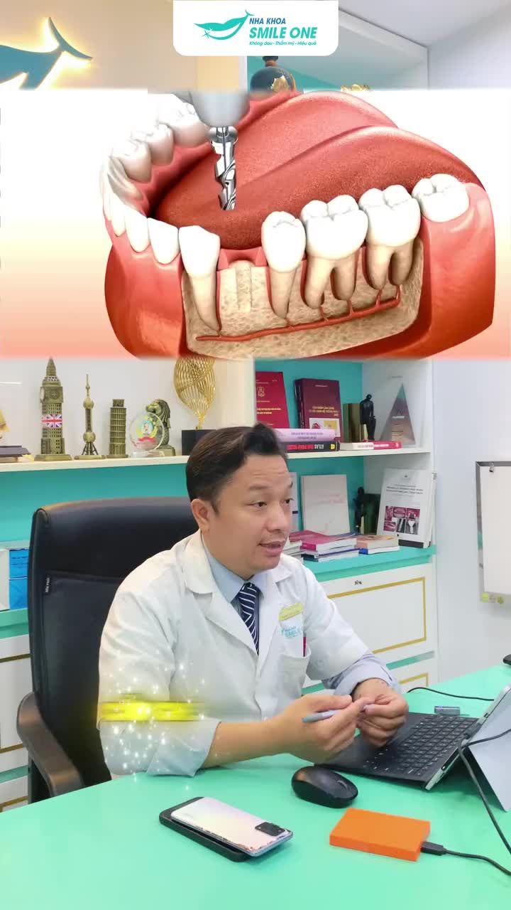 Cấy ghép Implant là gì và tại sao đây được coi là bước ngoặt của nha khoa hiện đại?