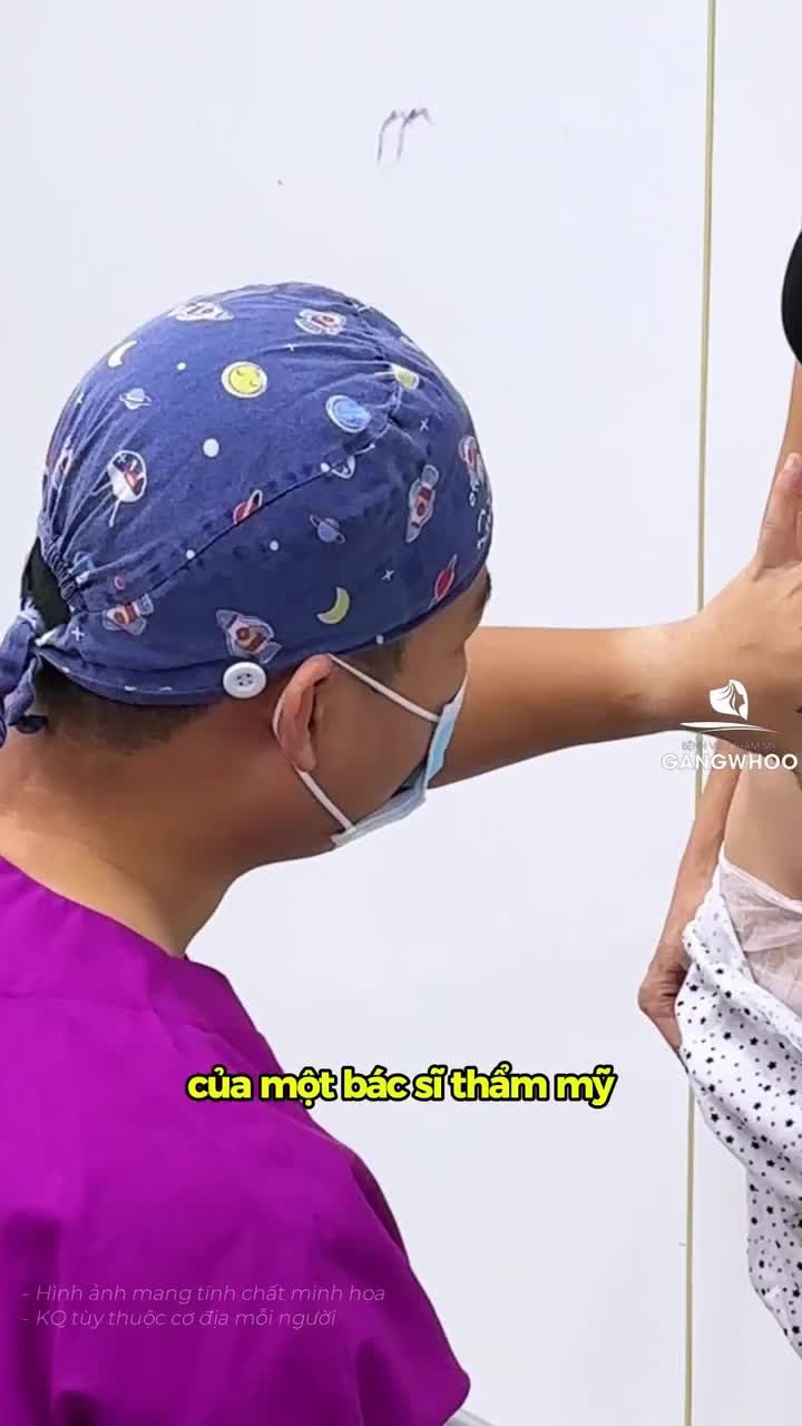 Chị Hiền, 51 tuổi: Hành trình căng da bụng nội soi tại BVTM Gangwhoo – Phân tích trước phẫu thuật (Phần 1)